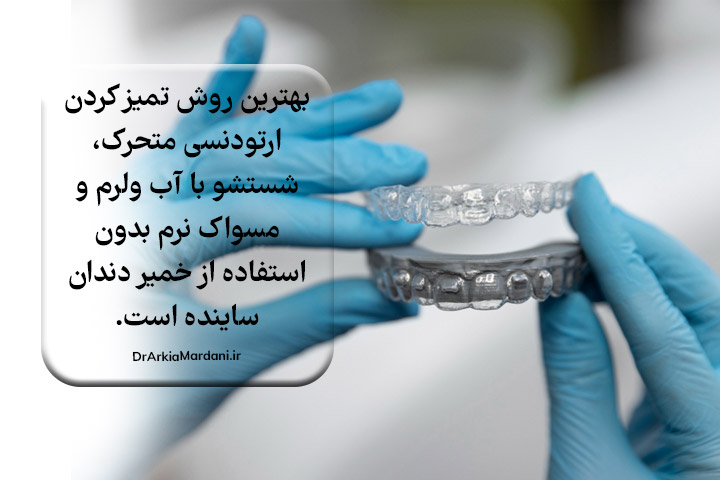 شستشوی ارتودنسی متحرک