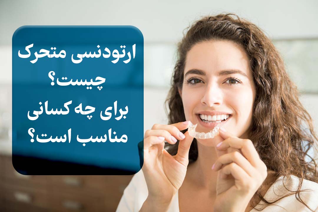 ارتودنسی متحرک چیه؟ برای کیا خوبه؟