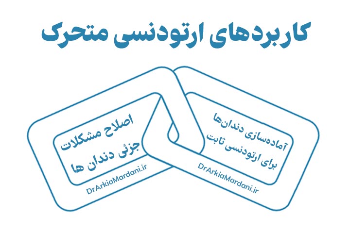کاربردهای ارتودنسی متحرک