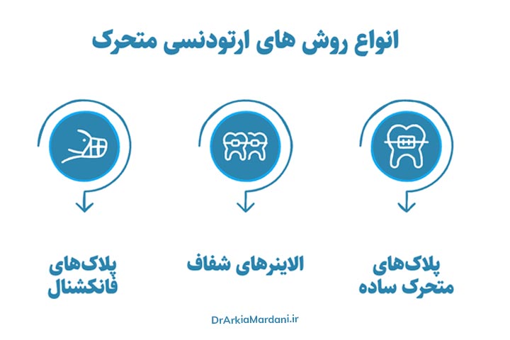 انواع روش های ارتودنسی متحرک
