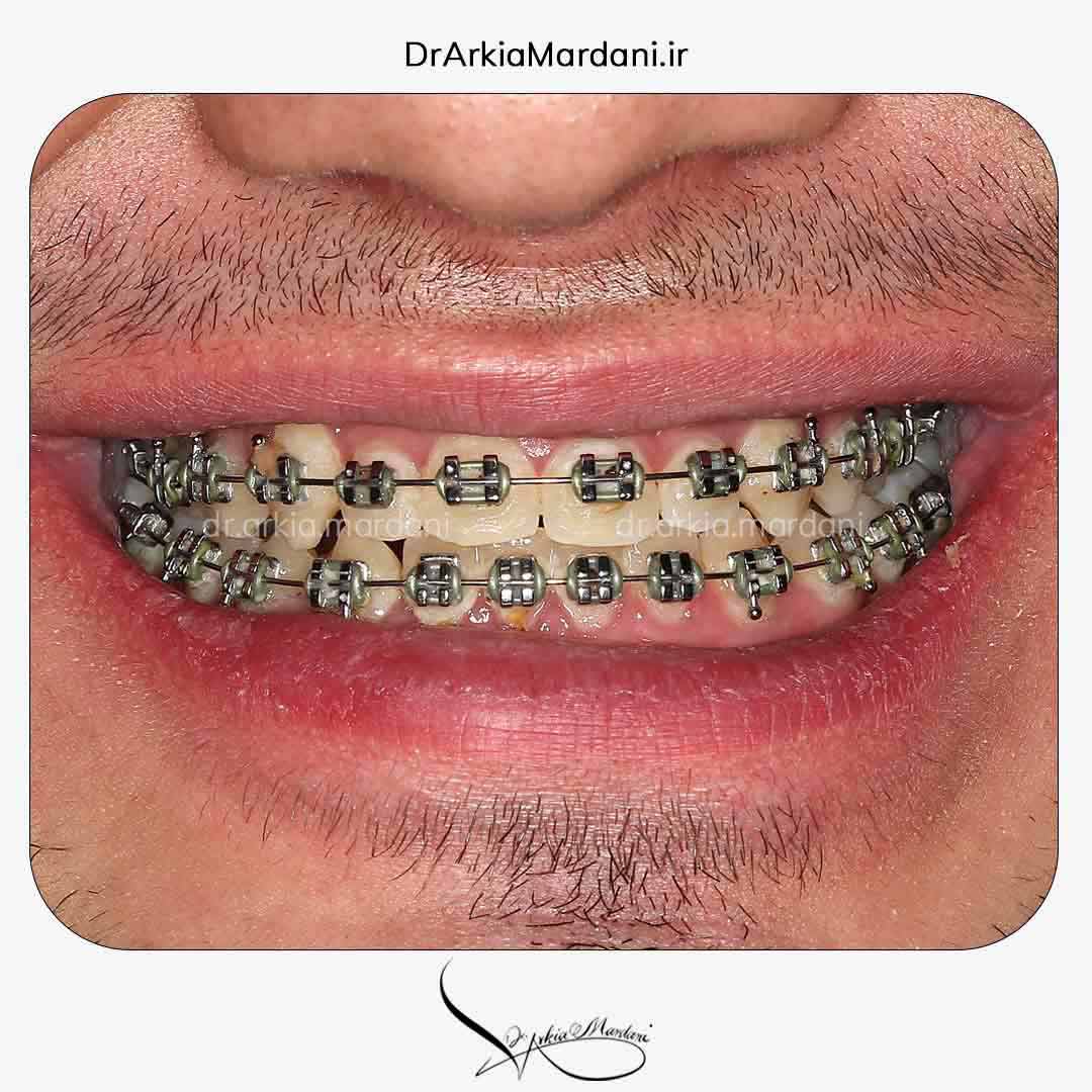 بعد