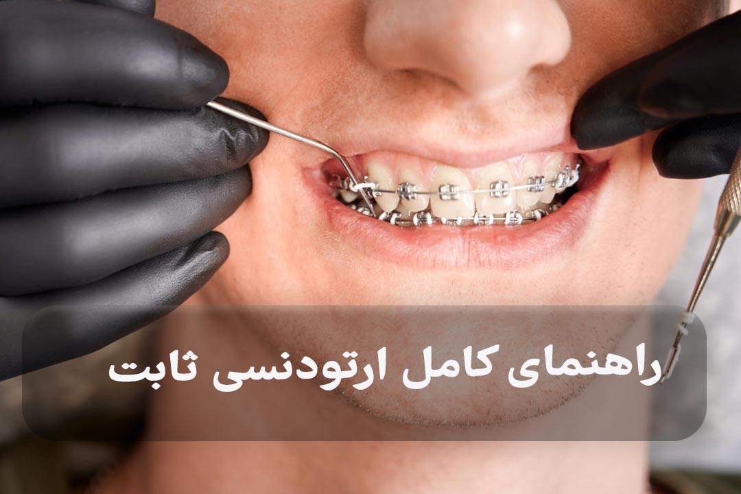 ارتودنسی ثابت چیست