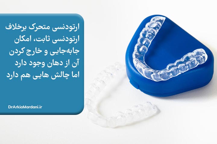 مزیت ارتودنسی متحرک
