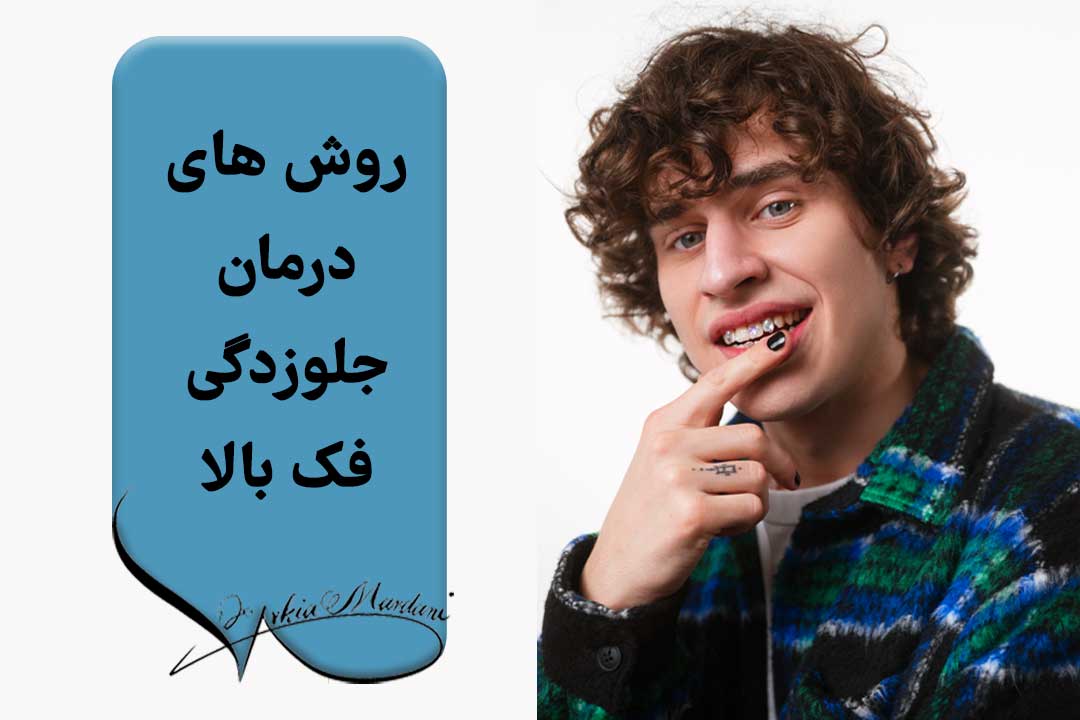 درمان جلوزدگی فک بالا