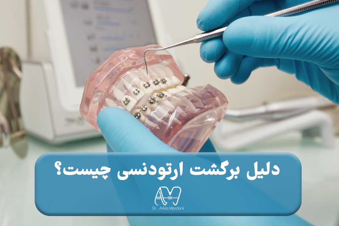 دلیل برگشت ارتودنسی چیه