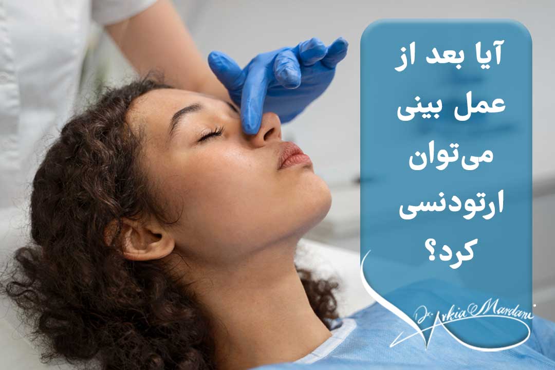 بعد از عمل بینی میشه ارتودنسی کرد؟