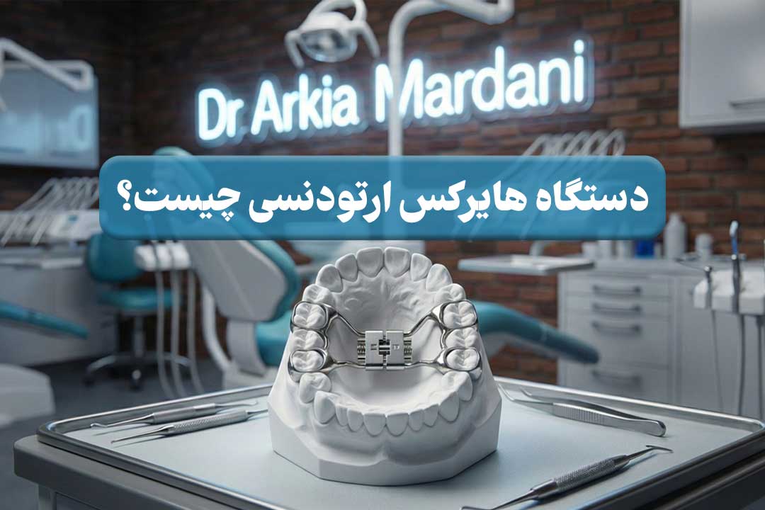 دستگاه هایرکس ارتودنسی چیست