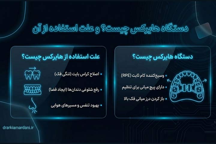 دستگاه هایرکس چیه و چه کاربردی داره