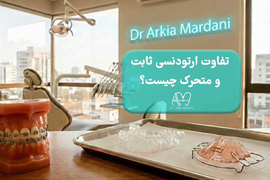 فرق ارتودنسی ثابت با متحرک چیست؟