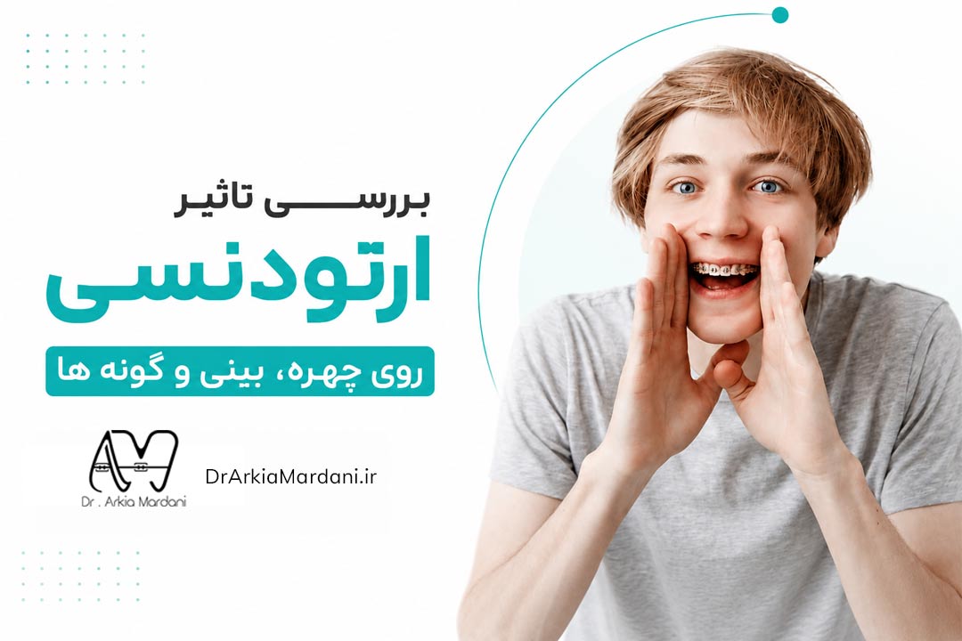 آیا ارتودنسی چهره رو تغییر میده؟